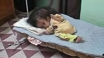 IMAGE(http://askdin.com/sites/default/files/gallery/images//15755/1_baby-fatimah-ahmed-born-with-two-heads-in-fallujah_1_.jpg)