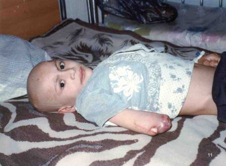 IMAGE(http://askdin.com/sites/default/files/gallery/images//15755/1_us_depleted_uranium_child_caused_1_.jpg)