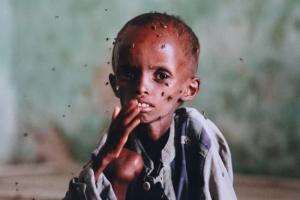IMAGE(http://askdin.com/sites/default/files/gallery/images//16778/medium/1_starving-child-in-mogadishu.jpg)